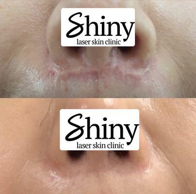 Shiny Laser Skin Clinic L A