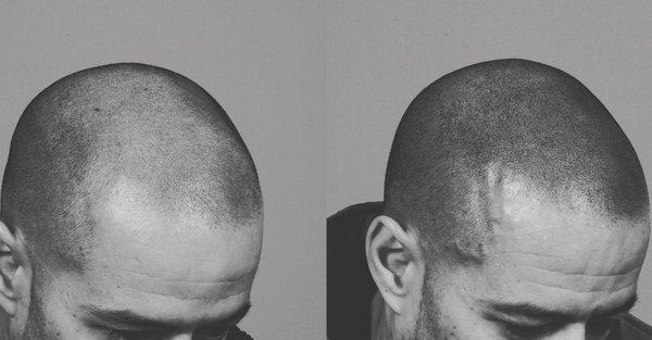 Arch & Crown Aesthetics