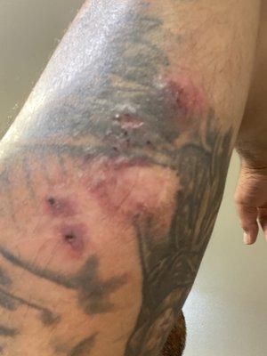 Tampa Bay Endoscopy Center