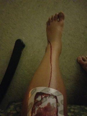 Orthoone at Presbyterian/St Luke's Medical Center