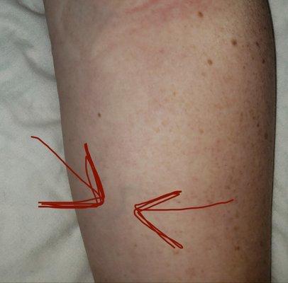 Newport Beach Surgery Center