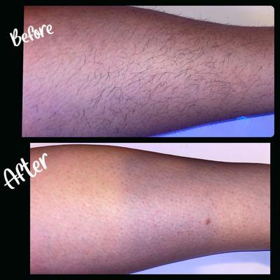 Leg wax: removes hair from the root to ensure long lasting results, waxing also lightly exfoliates the skin leaving it smooth