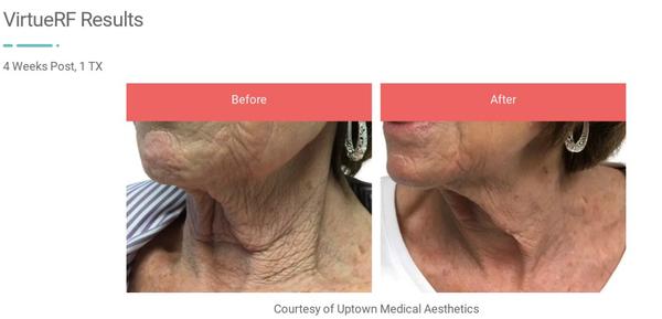 Flawless skin care and Aesthetics