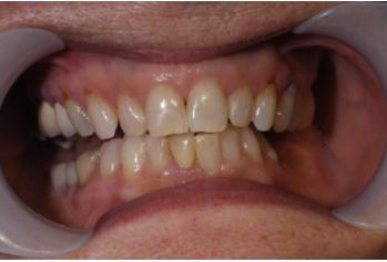 Jeffrey S Cummings, DMD