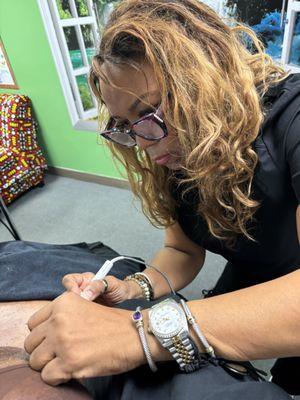 Mole Removal in action