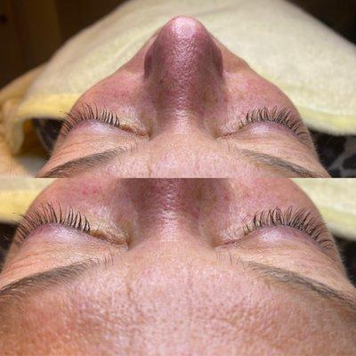 Lash lift
