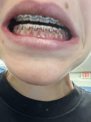 Smiles By Smith Orthodontics