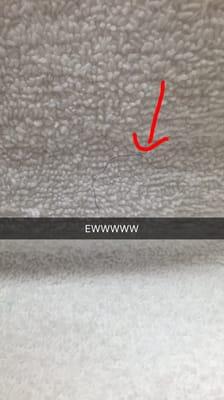 Pubic hair on towel.