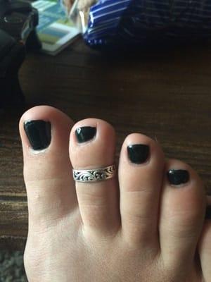 Second toe in is swollen and red on the right side.. You can see how uneven my toenail is.