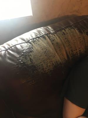 Leather peeling on recliner