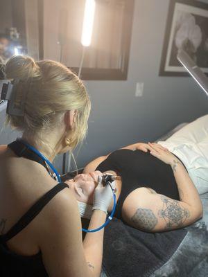 Get the best skin of your life with Hydrafacial!