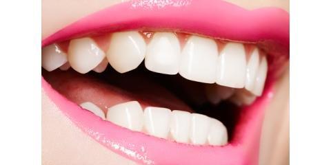 Dekker Elizabeth A, DDS