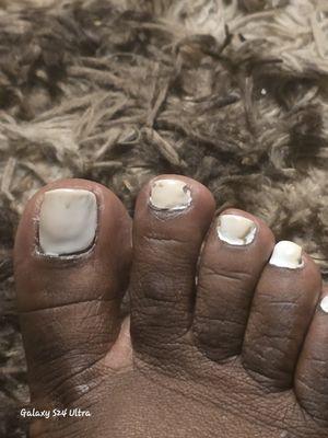 Got a pedicure Wednesday 11/19, get completely removed from the right foot on Friday 21. Contact the nail tech, he encouraged me to come 11/