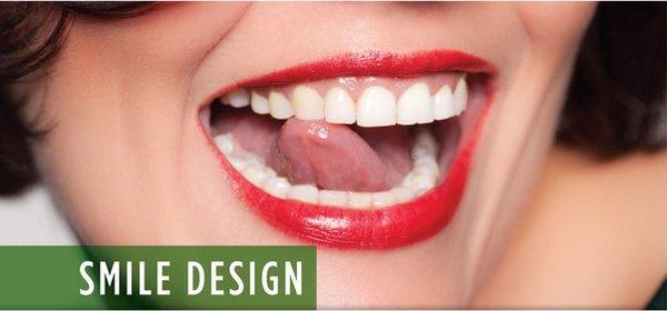 Celebrity Style Smile Design. Restoration - Teeth Whitening - And More!