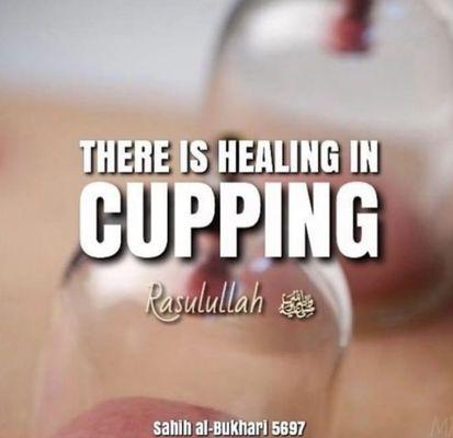 World of cupping Hijama