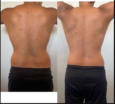 Men tighten and tone back. Back and sides