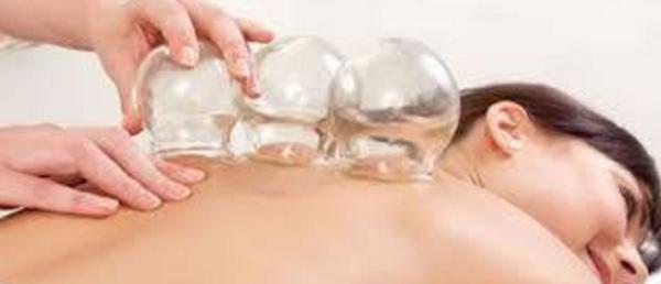 Cupping Therapy at Elite