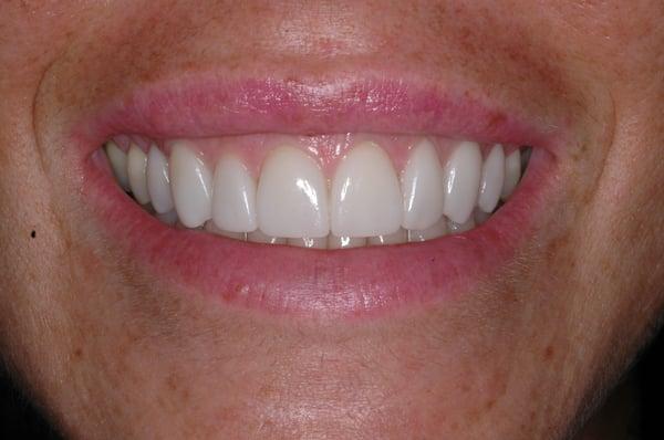 Precision Arts Dental Associates