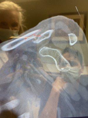 Verde Valley Orthopedics PC