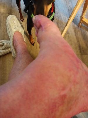 Advanced Foot & Ankle Center