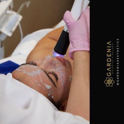 Oxygeneo Hydrate facial! 3 in 1 super facial.
