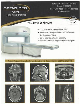 Opensided MRI of Denver