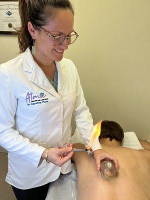 Fire cupping therapy.