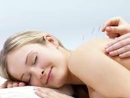 Acupuncture should not be painful look how comfortable the patient while having the treatment