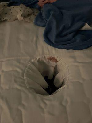 Stains on the sheets.