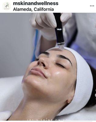 Hi everyone! Hurry! HYDRAFACIAL May Special -- Save $100 Today!