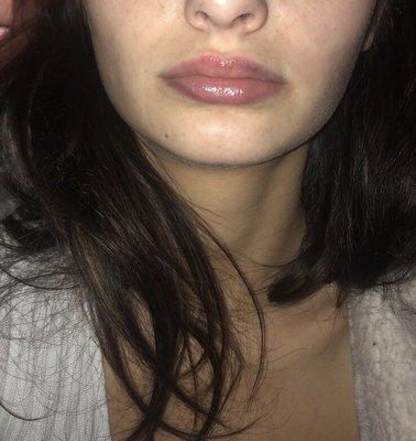 Beautiful U Medical Spa