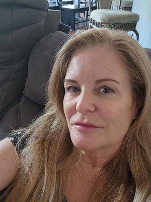 Miss Botox Fort Worth