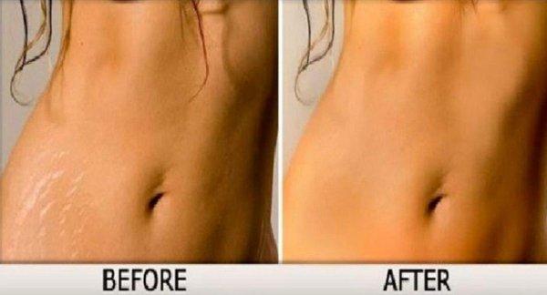 Sheen Medical Tattoo