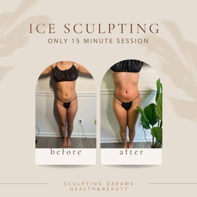 Ice Sculpting