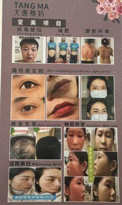 Different kinds of treatment that can help your needs to become more pretty and healthy.