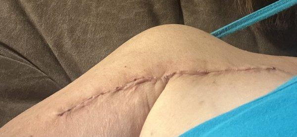 Orthopedic and Sports Institute of the Fox Valley