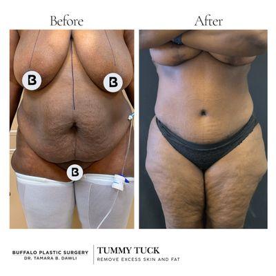 Tamara Dawli, MD - Buffalo Plastic Surgery