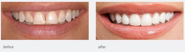 Richard B Waghalter DDS - Healthy Smiles