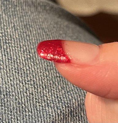 Rough spot where gel had not cured properly