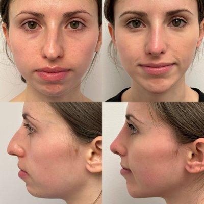 Thomas W Loeb, MD PC