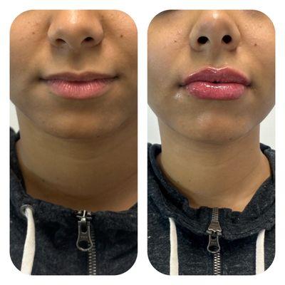 Advanced Skin Renewal LLC