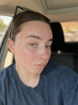 Skin after the facial
