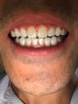 Santa Ana Orthodontics