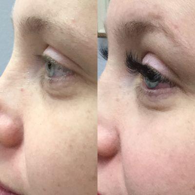 Amazing! Short pale lashes were nearly invisible. Now they are lush and beautiful.