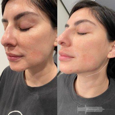 Brenda Injects Aesthetics