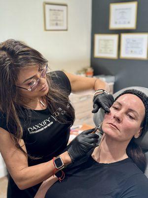 Liquid Facelift-RHA dermal fillers & DAXXY (botox)