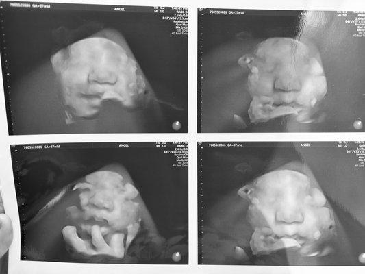 Coachella Ultrasound