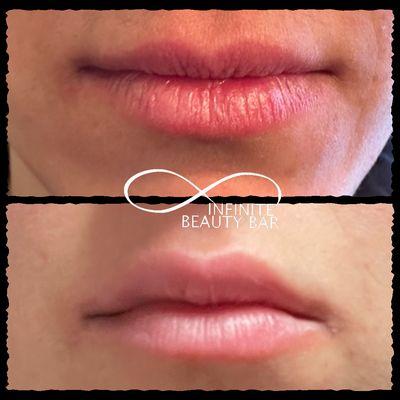 Infinite Beauty Bar