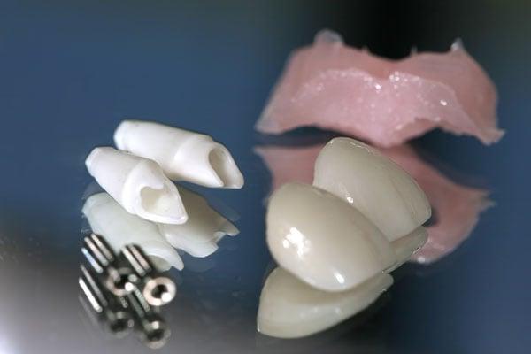 Deedent Dental Solution