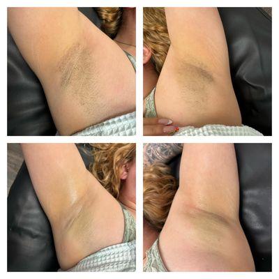 Underarm Wax